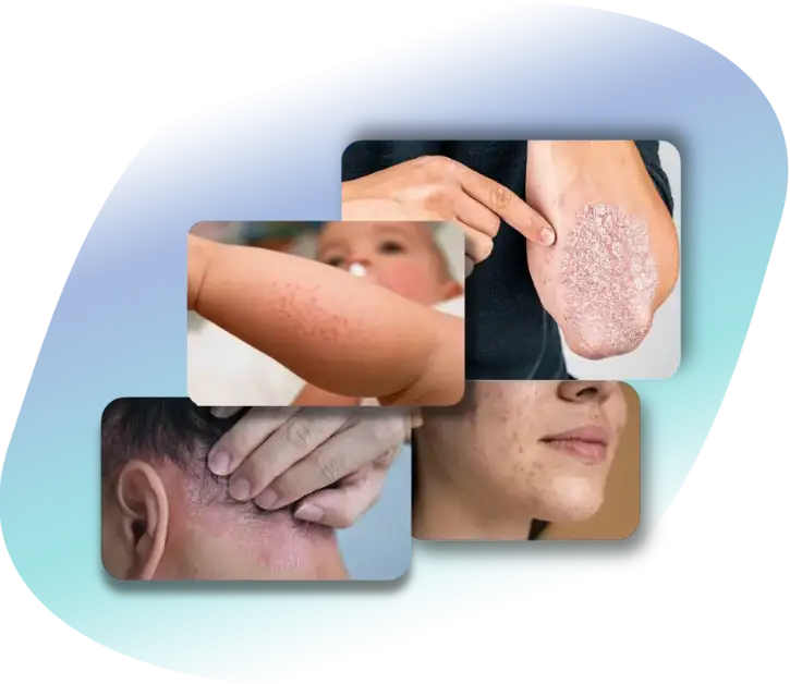 dermatologo a gravina